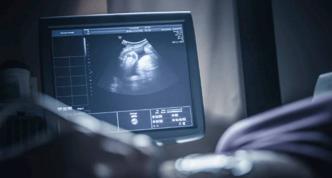 A Step-by-Step Guide on How to Become a Ultrasound Technician
