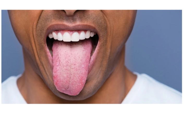 What Causes Tongue Biting and How Do You Fix It?